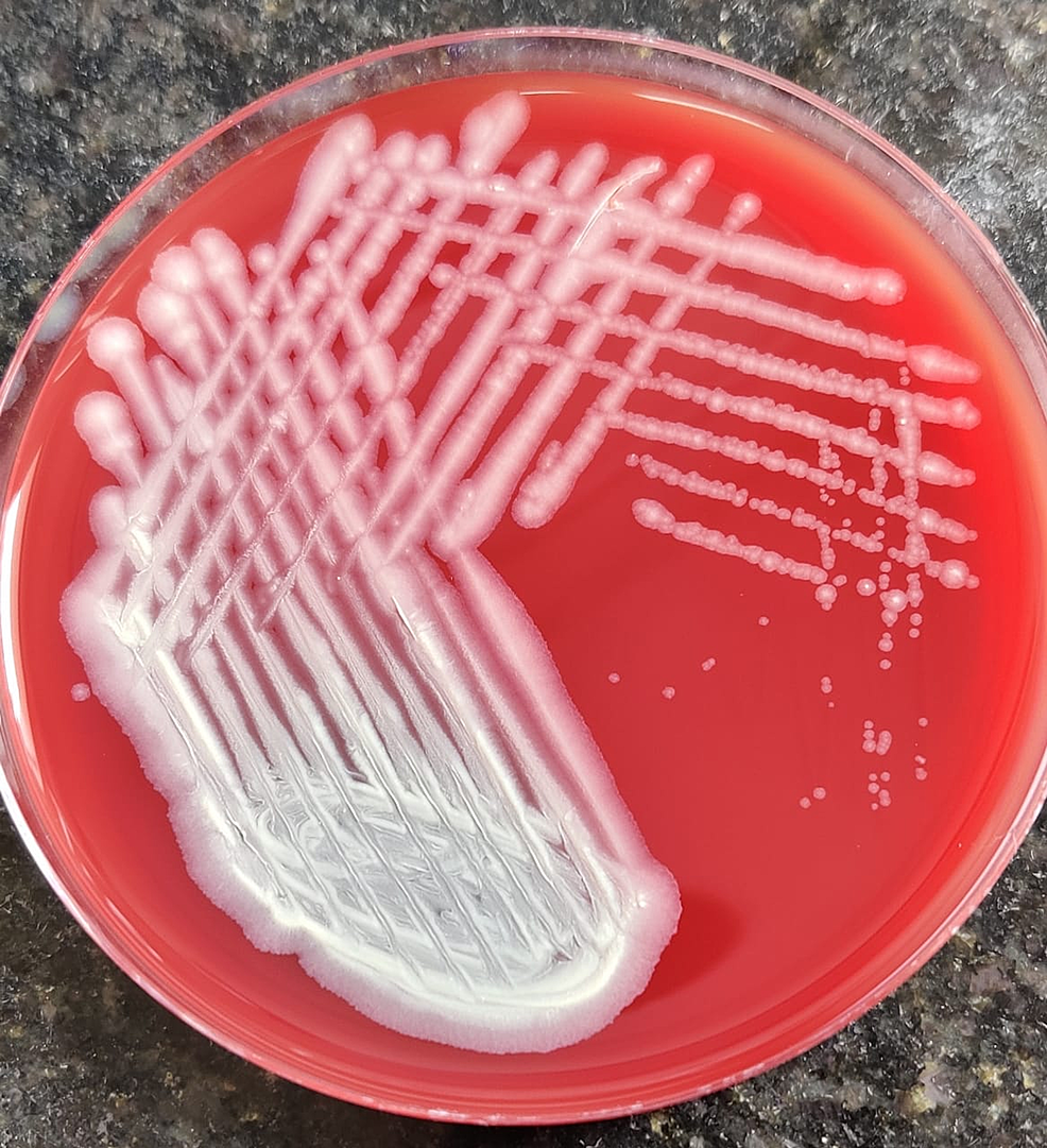 Cureus | Corynebacterium jeikeium as an Unusual Cause of Keratitis: A ...