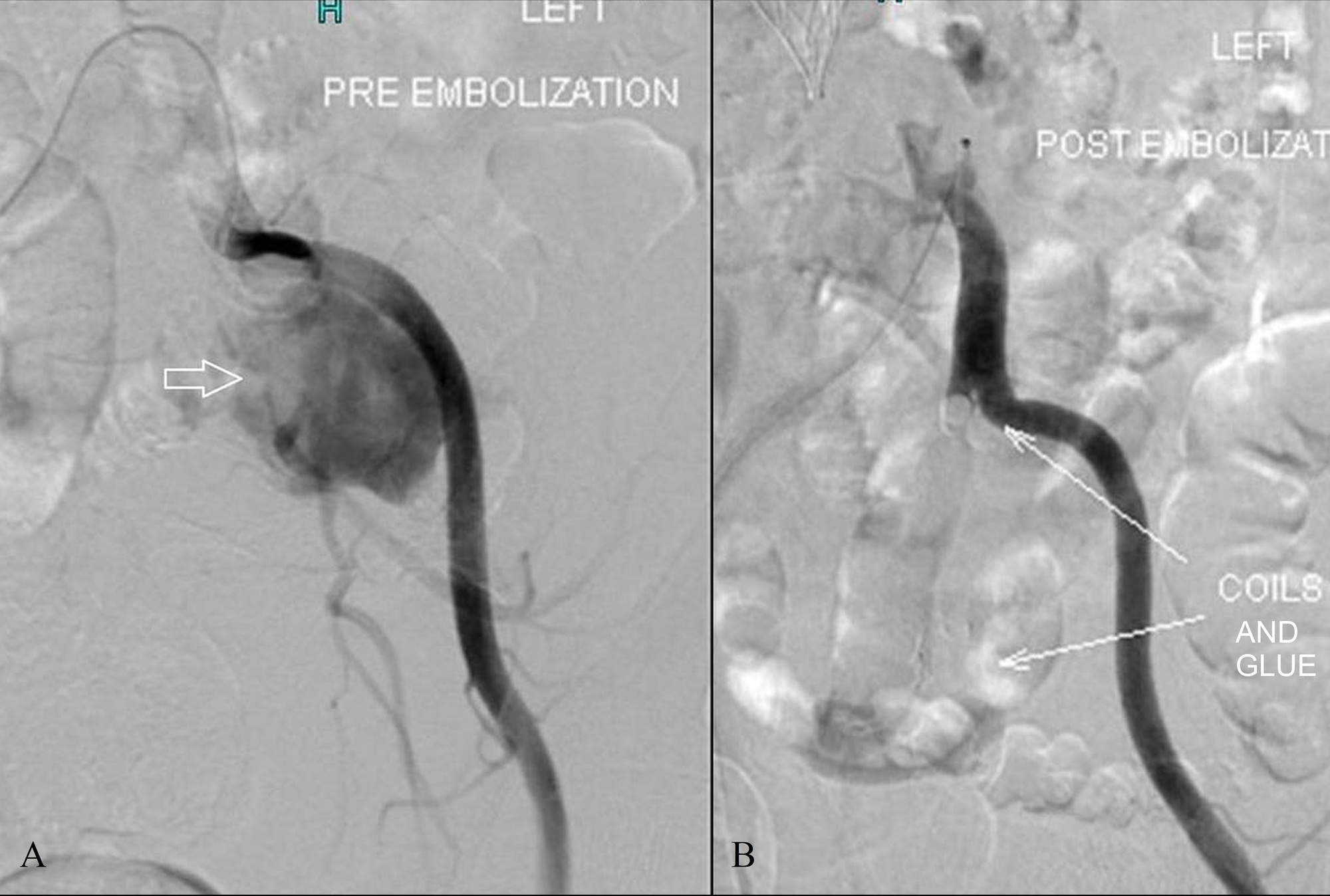 Cureus Institutional Review of Hemorrhagic Pelvic Emergencies