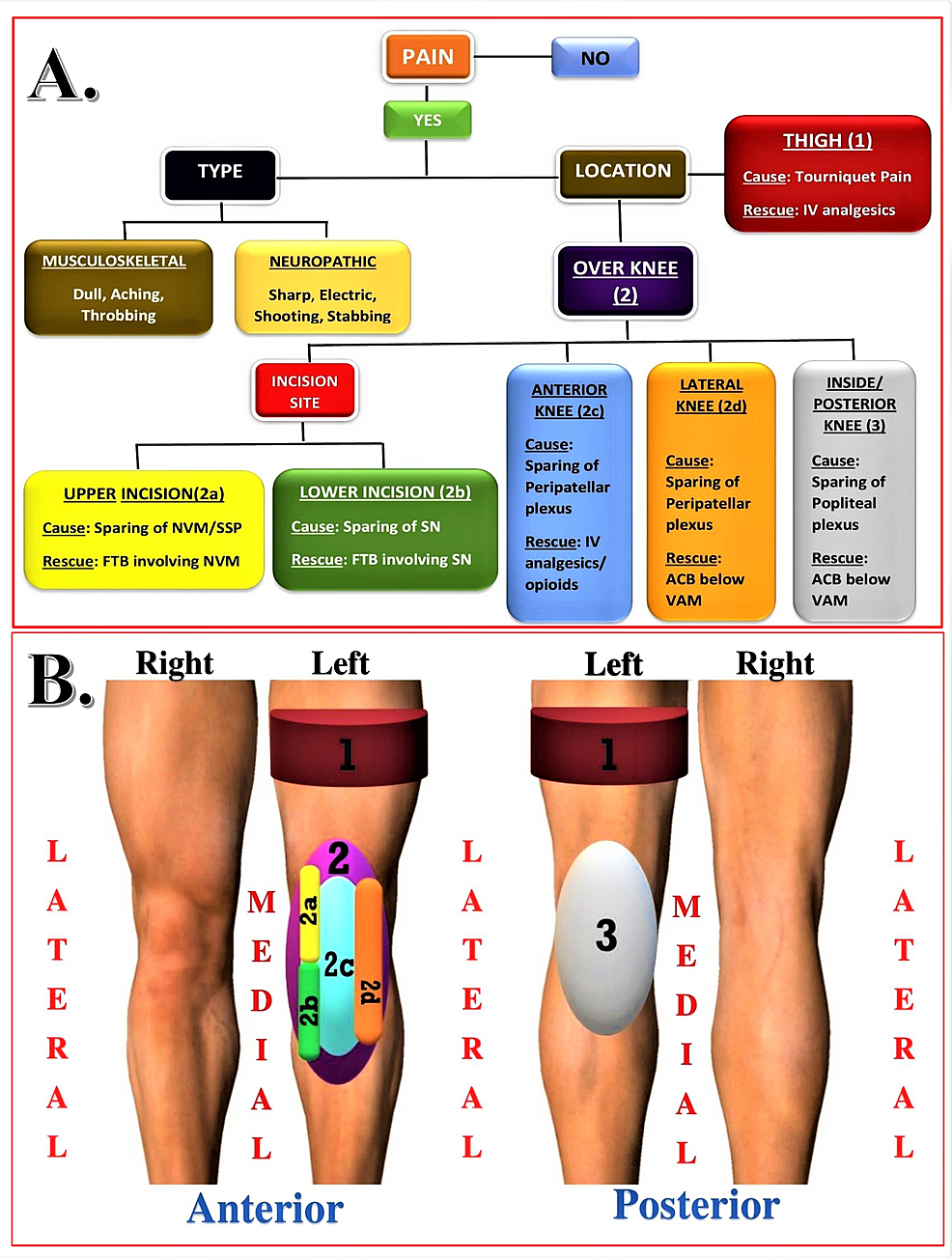 Cureus | Comparing Analgesic Efficacy of a Novel Dual Subsartorial ...