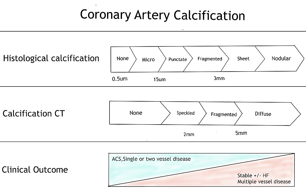 Coronary Artery Calcium Score: The Best Way to Know if You Have