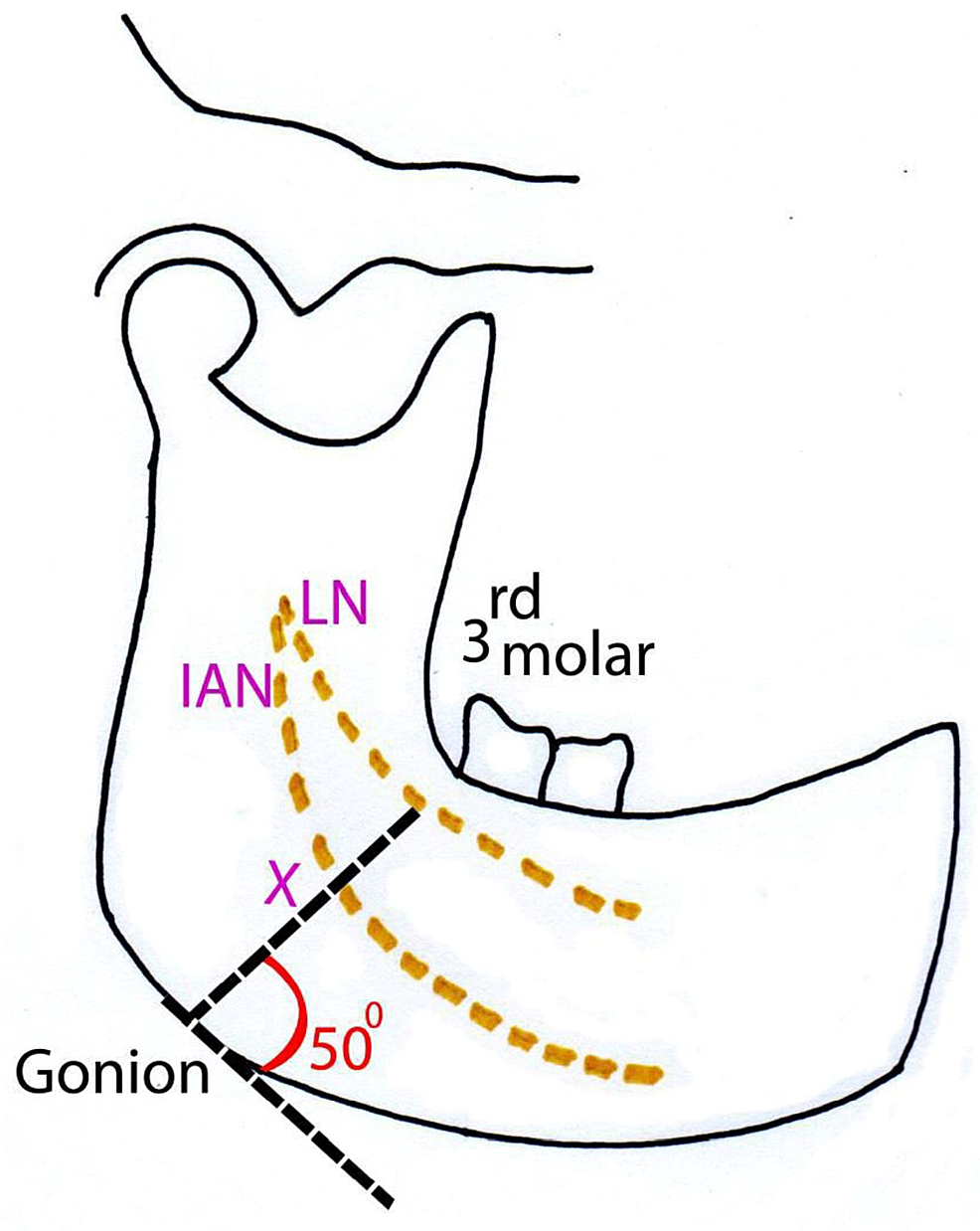 Cureus Topographical Landmarks for the Identification of Branches of