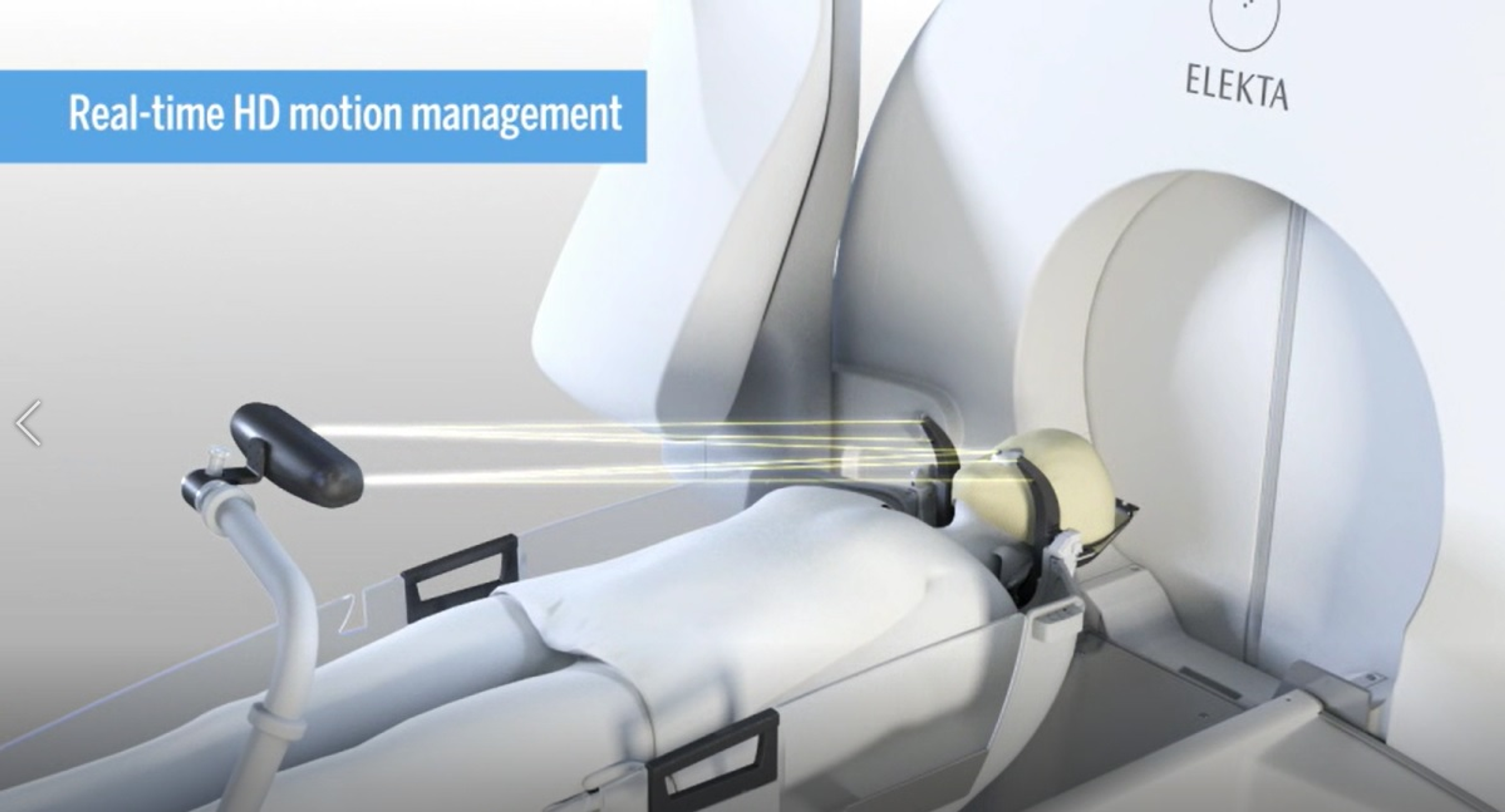 Cureus Gamma Knife Radiosurgery With Mask Fixation Under General
