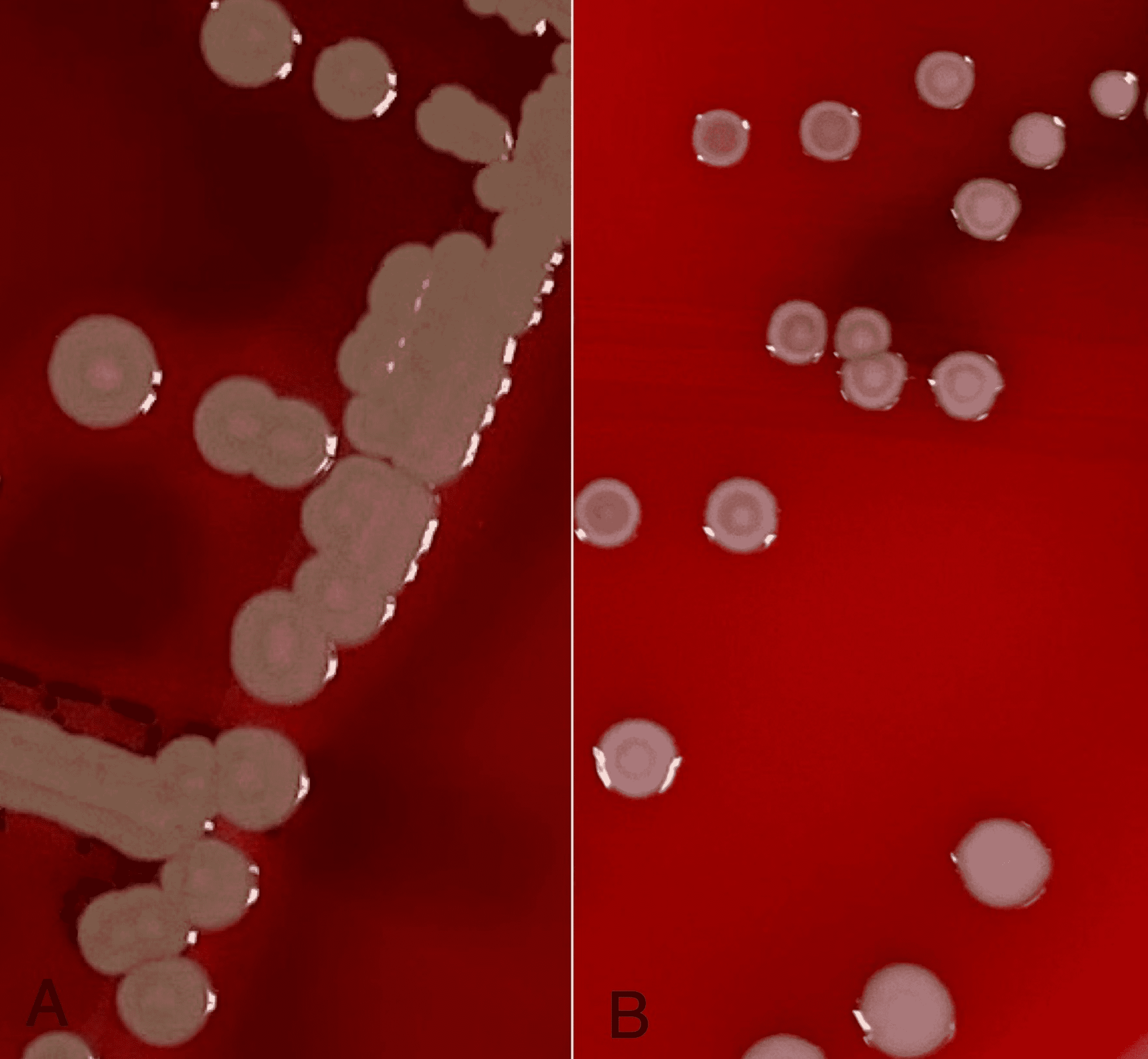 Cureus Sensitivity And Specificity Of A Novel Colony Characteristic For Determination Of Methicillin Resistant Staphylococcus Aureus