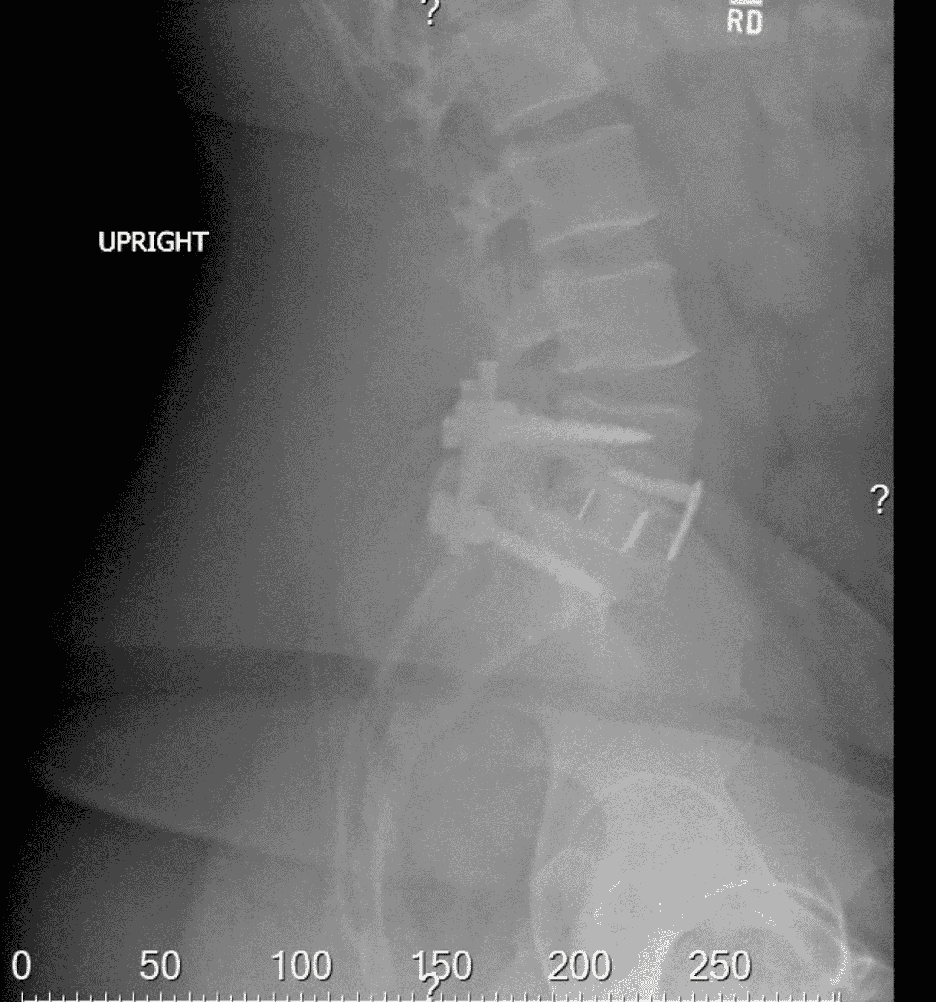 The Lumbar Spine Radiology Key - vrogue.co