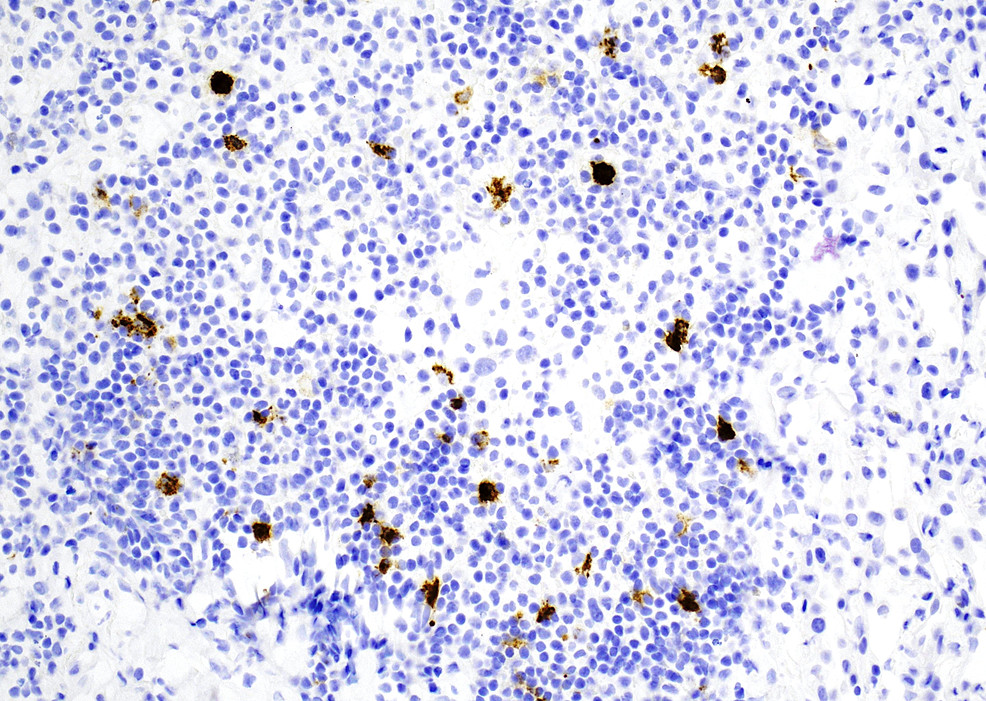 Langerin-(CD207)-positive-staining-for-Langerhans-cells,-20x
