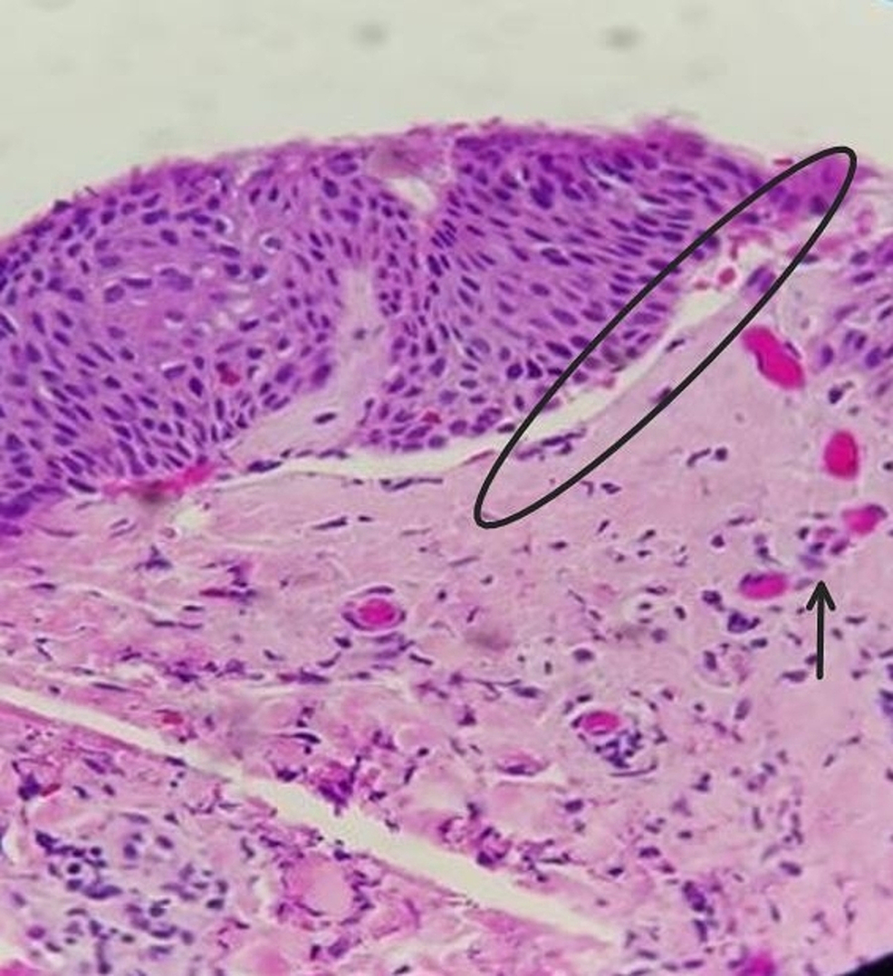 Bullous Pemphigoid Immunofluorescence