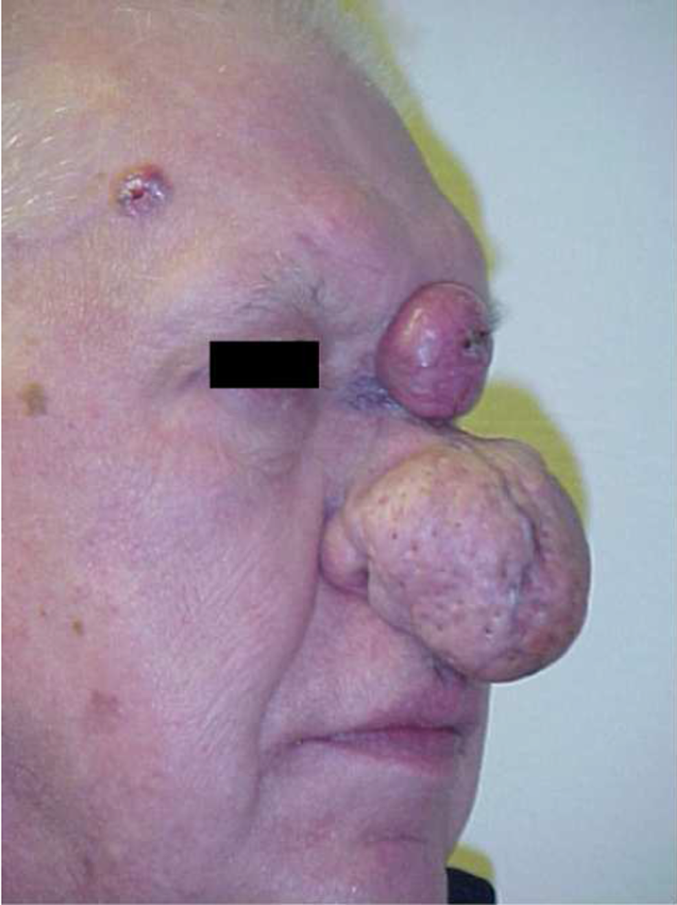 Preoperative-appearance-