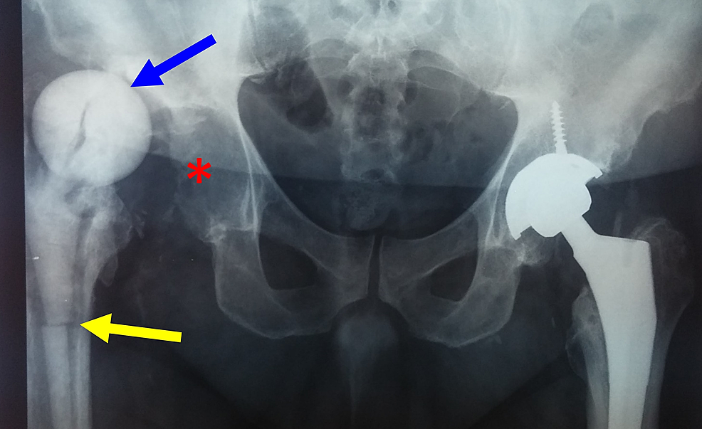 Cureus Current Concepts on the Application, and