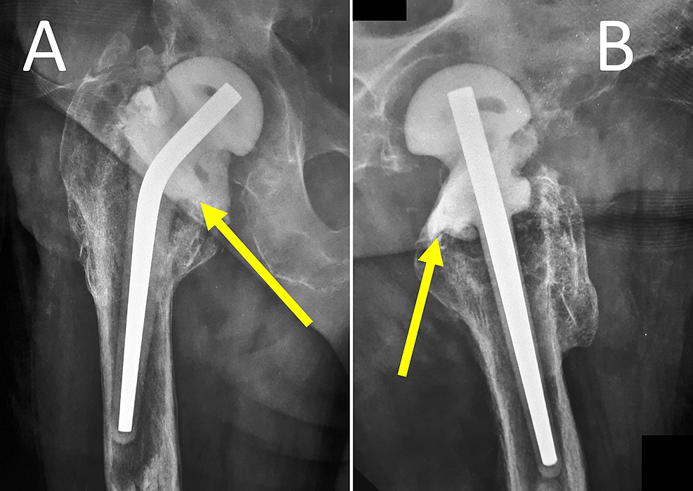 Cureus Current Concepts on the Application, and