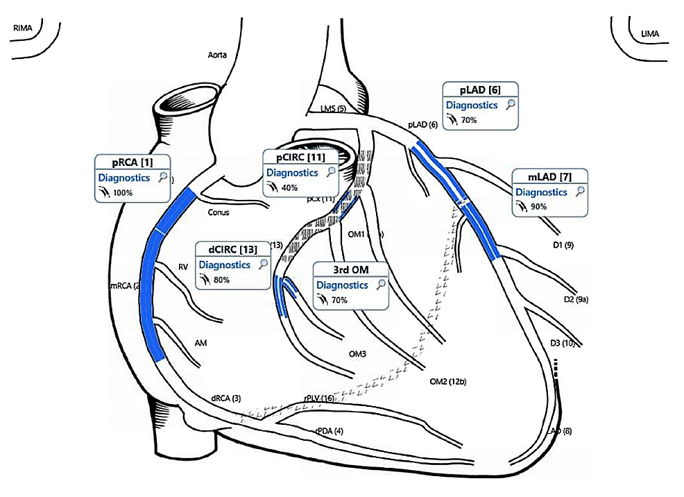 Cureus | Atrial Fibrillation With Decompensated Heart Failure ...