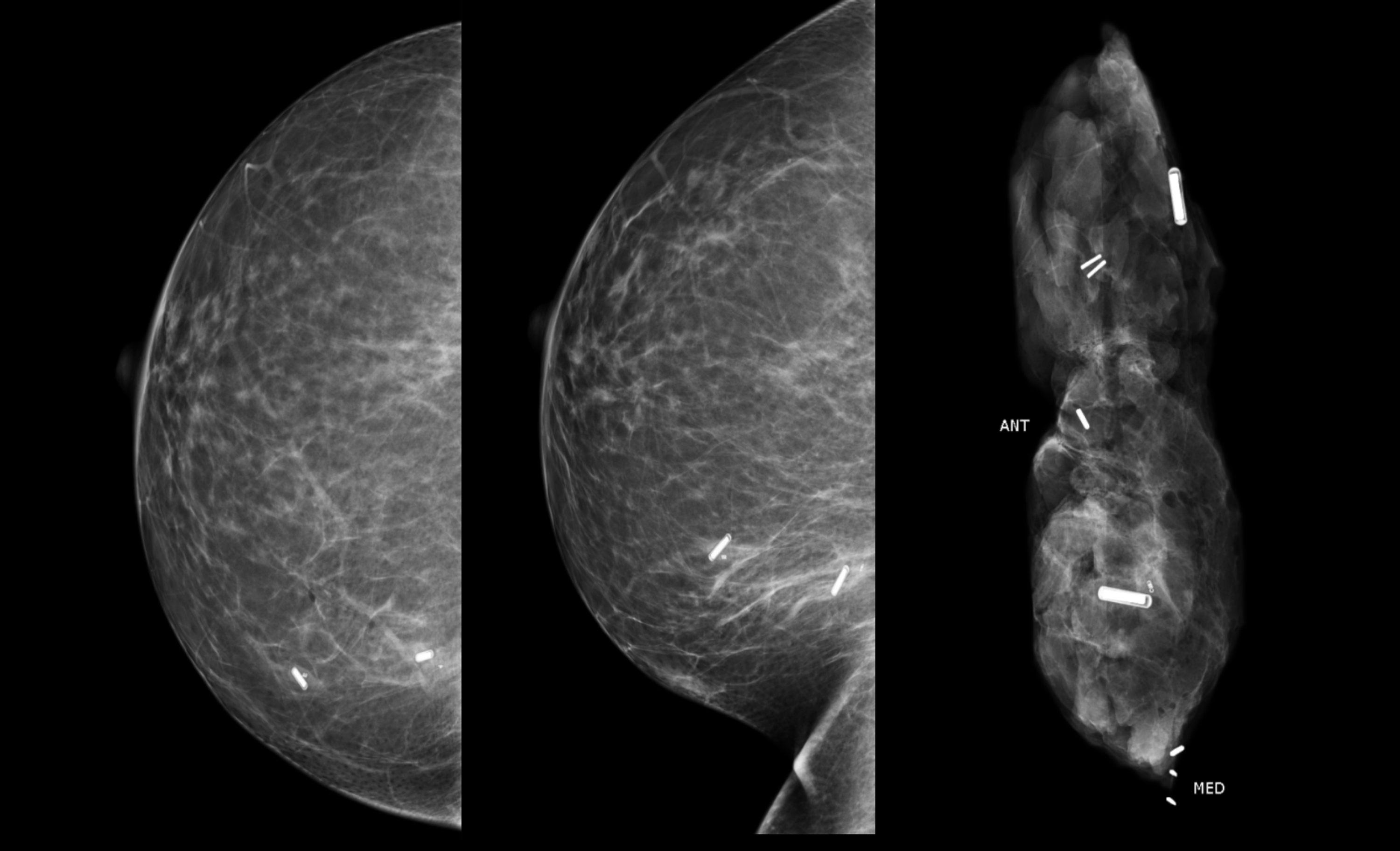Cureus RadioFrequency Identifier Devices (RFIDs) Our Experience