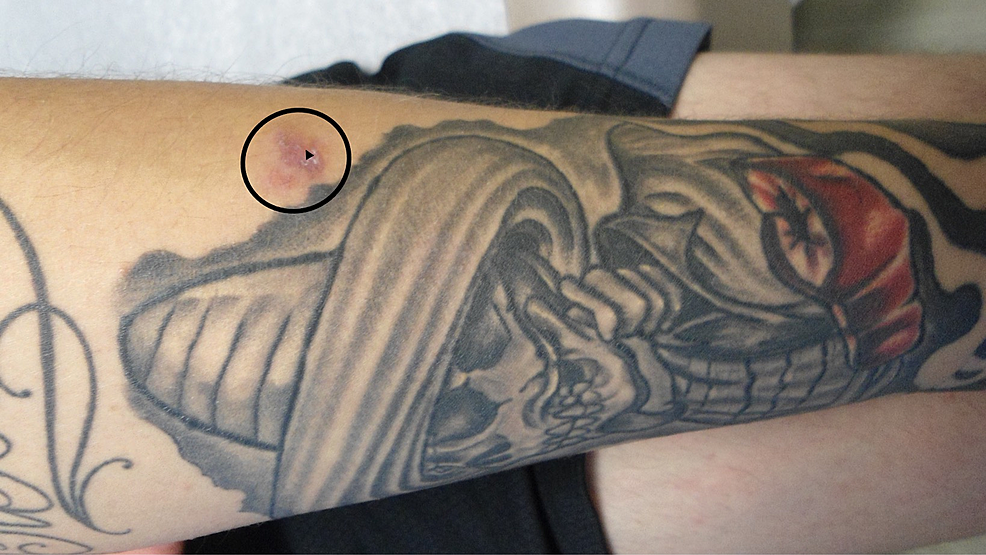 is my tattoo infected ? : r/tattooadvice