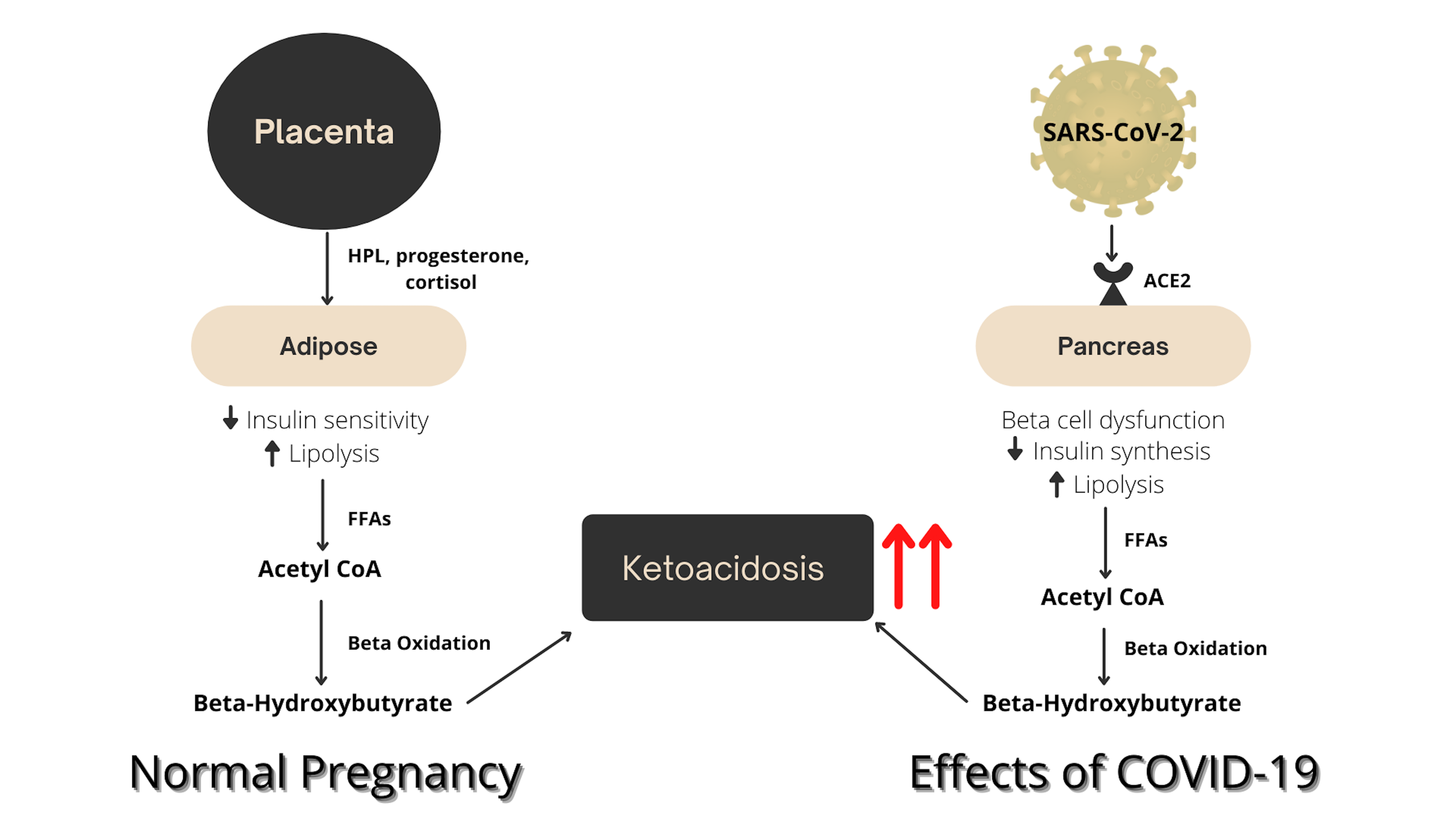 Cureus Euglycemic Diabetic Ketoacidosis in a Pregnant Woman With
