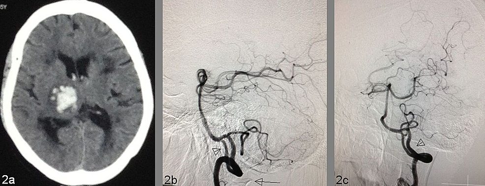 extracranial intracranial bypass surgery impact of caseload Thanks for downloading the file key standards in healthcare informatics from category extracranial-intracranial bypass surgery: impact of work related stress. extracranial intracranial bypass surgery impact of caseload Thanks for downloading the file key standards in healthcare informatics from category extracranial-intracranial bypass surgery: impact of work related stress.