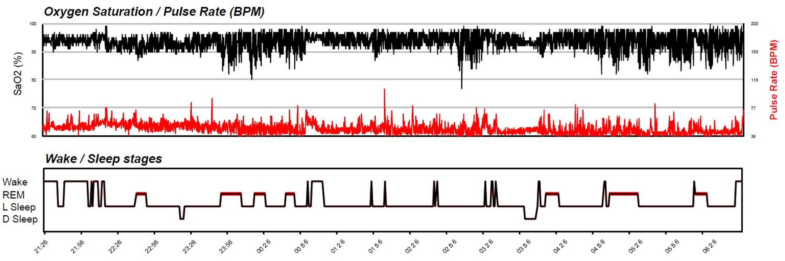 Cureus Hidden Dangers of Severe Obstructive Sleep Apnea