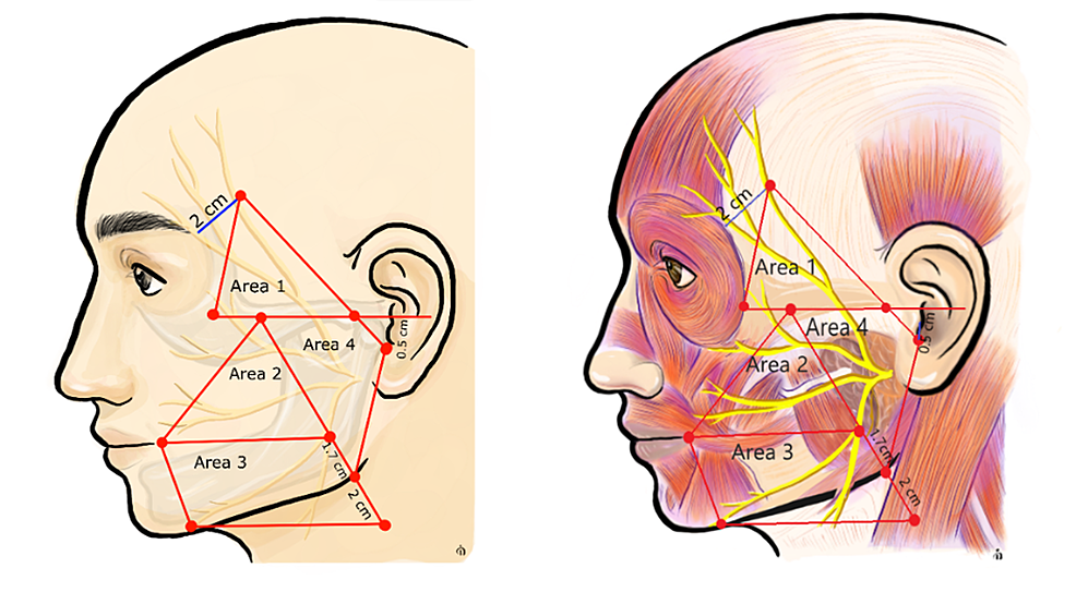 Anatomy and clinical applications of the mandibular nerve.