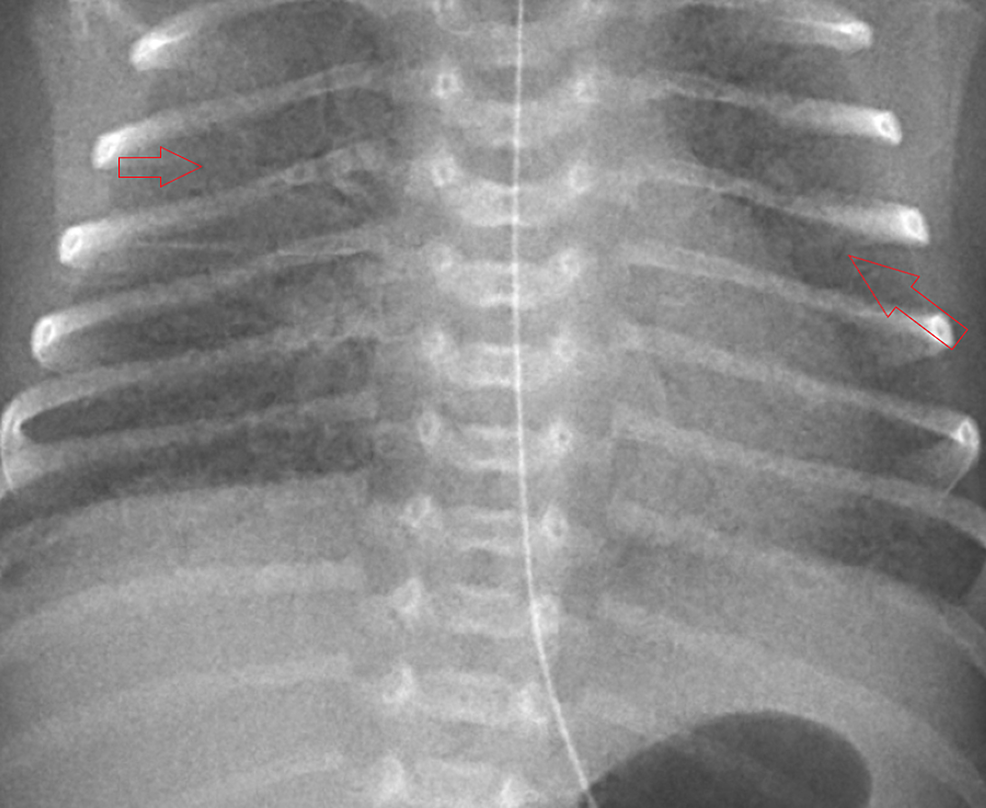 cureus-transmission-of-covid-19-from-an-asymptomatic-mother-to-fetus