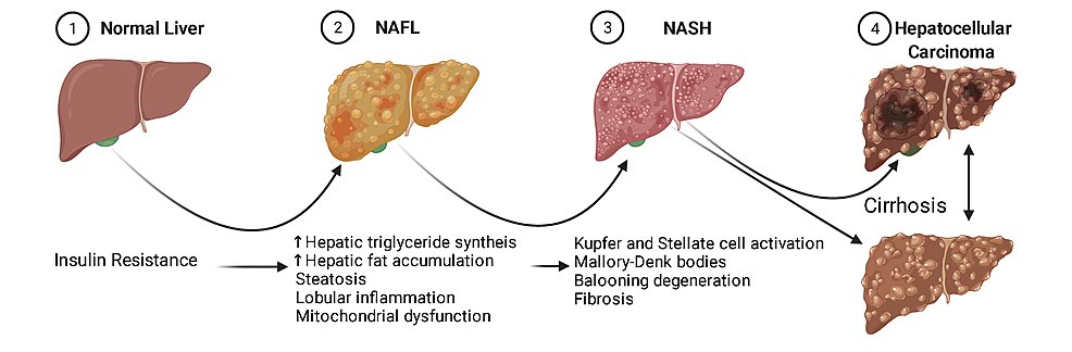 Comparing The Efficacy And Safety Of Obeticholic Acid And Semaglutide ...