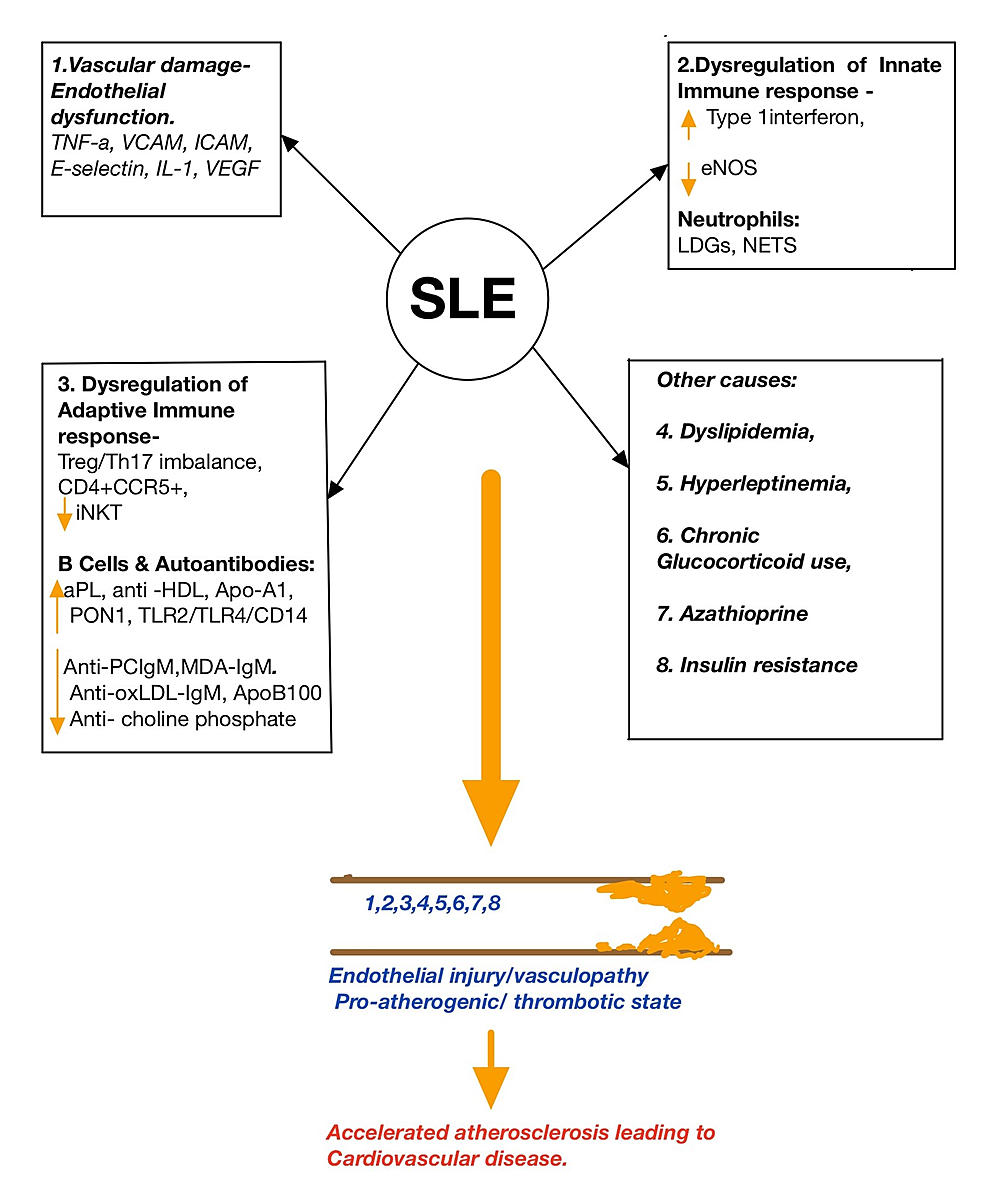 cureus-systemic-lupus-erythematosus-and-cardiovascular-disease