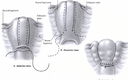 Cureus | Towel Uterus Model For Uterine Compression Sutures Technical ...