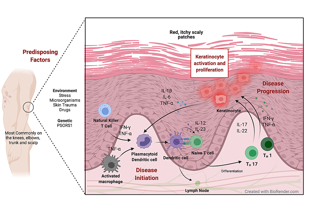 Targeting the NOD-, LRR- and Pyrin Domain-Containing Protein 3 (NLRP3 ...