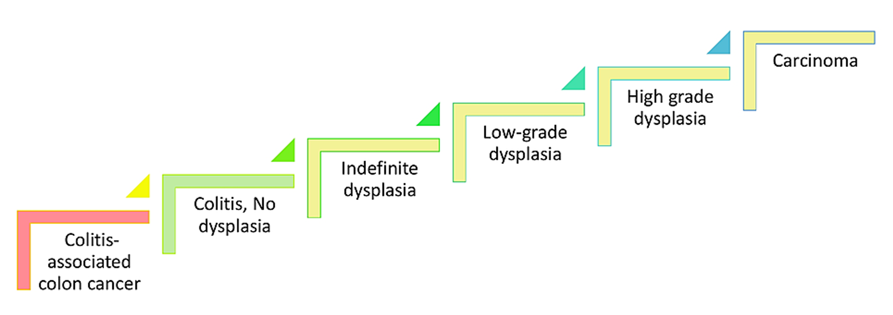 Cureus Ulcerative ColitisInduced Colorectal Carcinoma A Deleterious Concatenation