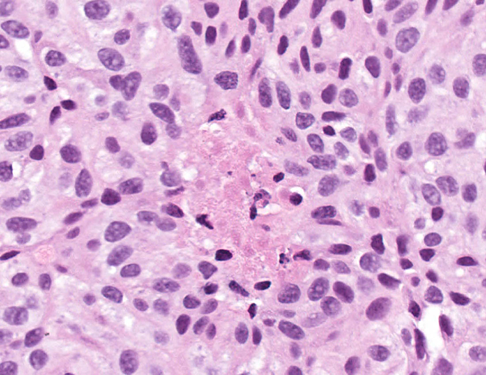 Histologic-section-in-high-magnification