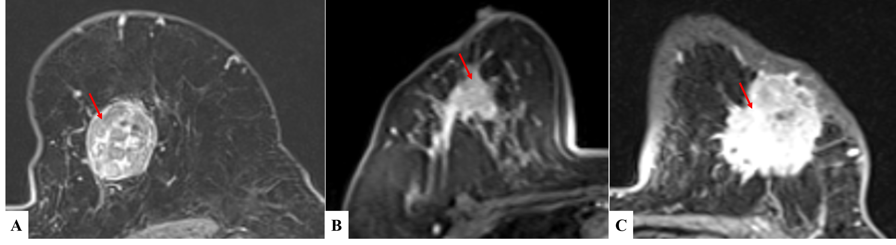 Cureus Multiparametric Magnetic Resonance Imaging In Evaluation Of