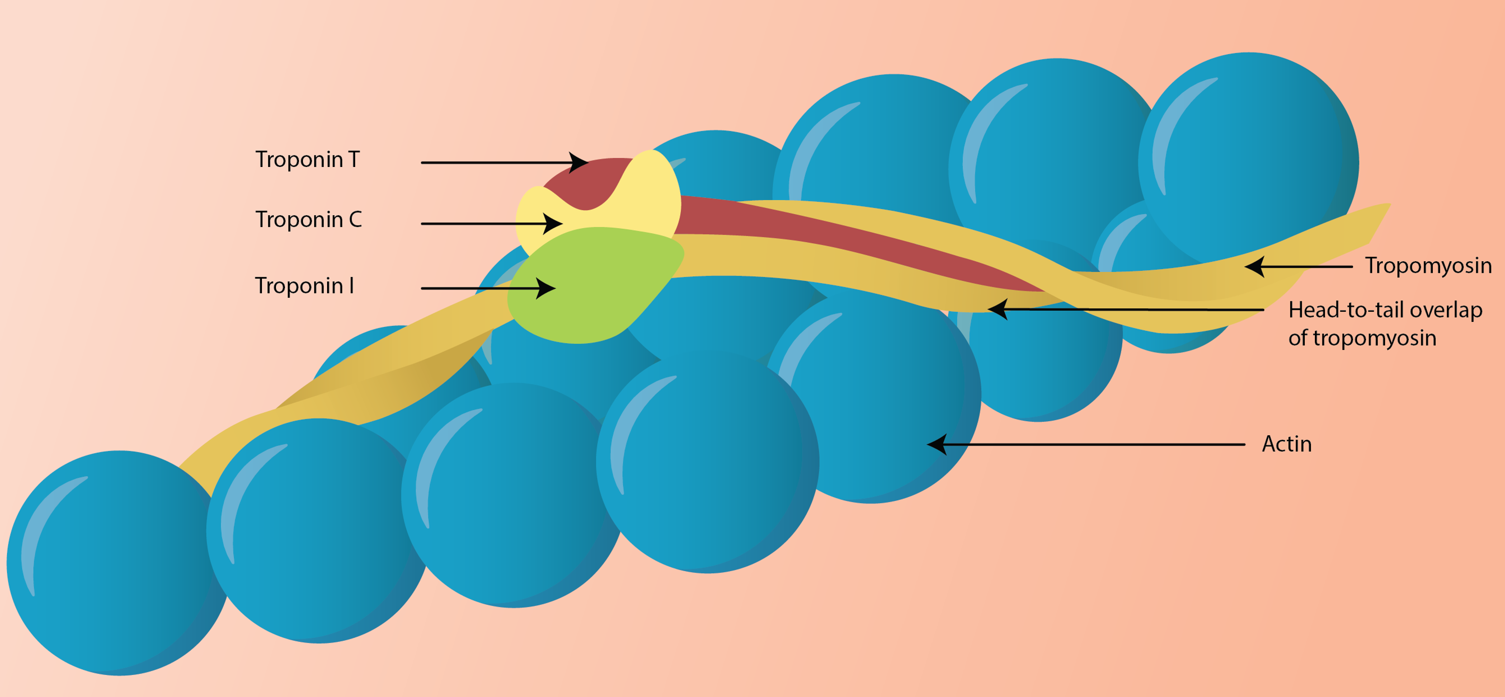 Cureus Interpretation of Cardiac and NonCardiac Causes of Elevated