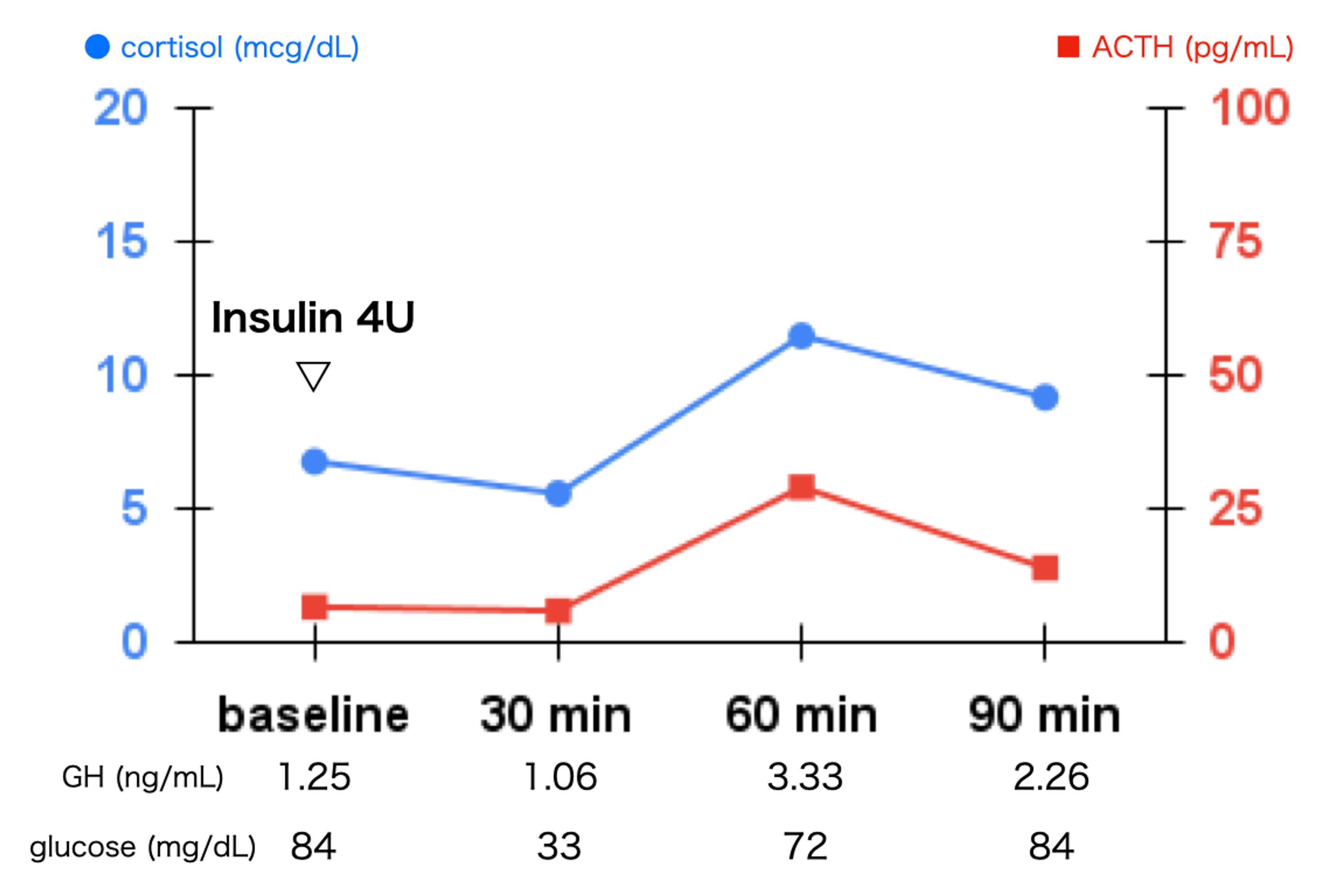 Cureus Secondary Adrenal Insufficiency After COVID 19 Diagnosed By
