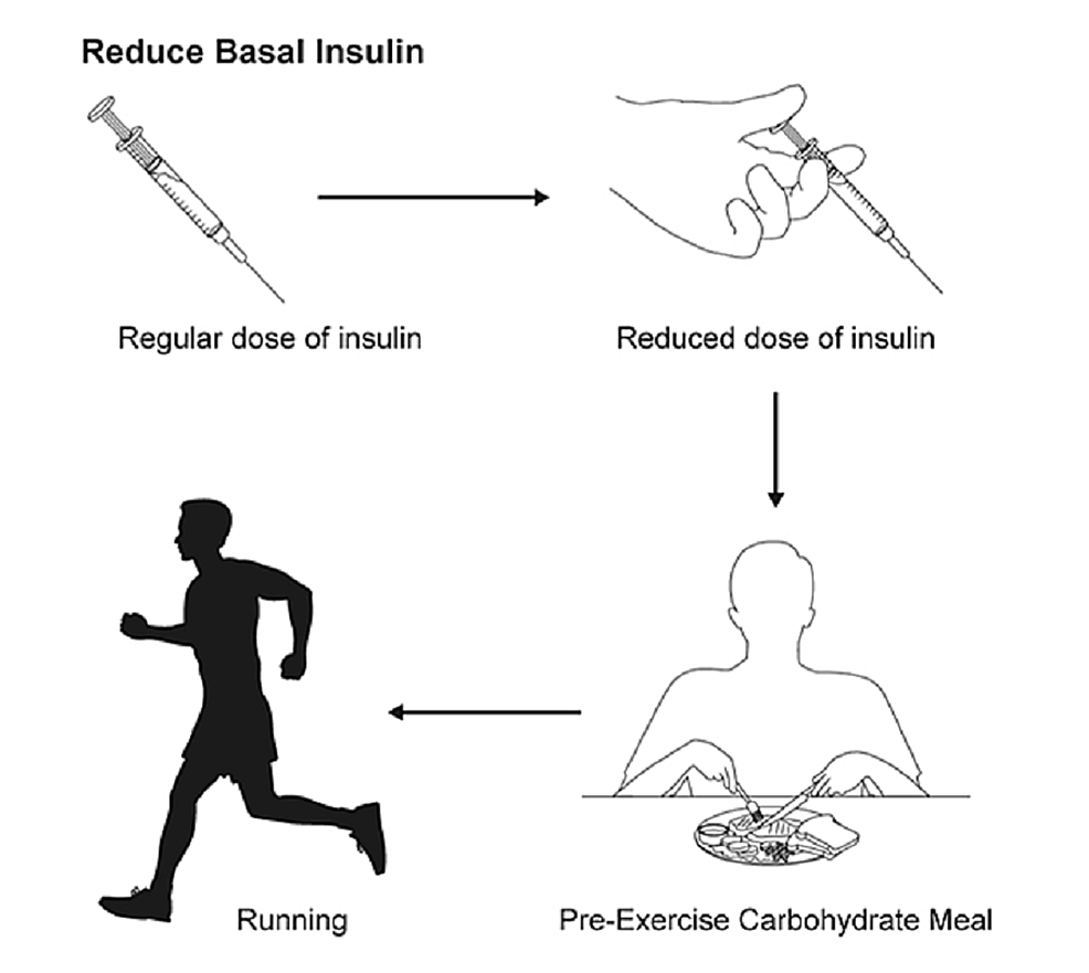 Insulin-adjustment-prior-to-exercise