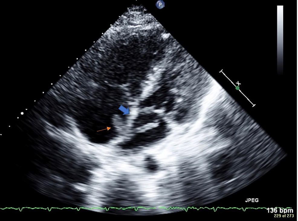 Two-dimensional-transthoracic-echocardiogram-with-color-flow-and-Doppler-ultrasonography.