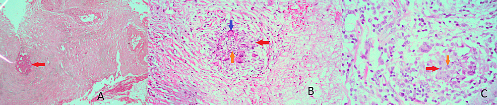 Hematoxylin-and-eosin-stained-light-microscopic-images.