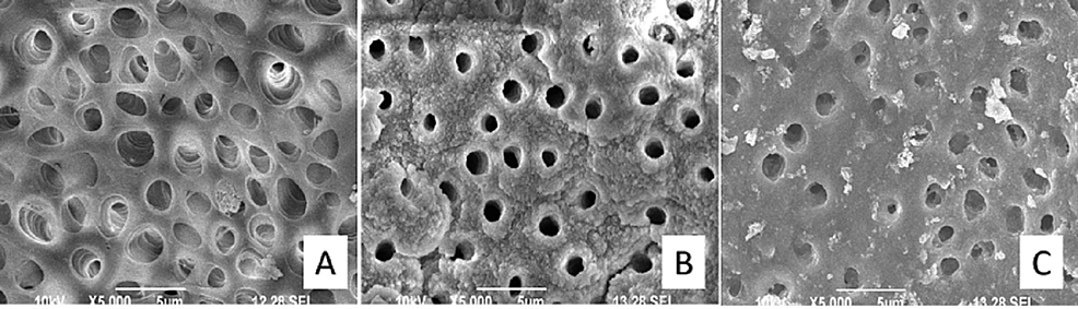 SEM-images-of-experimental-groups-at-5000X-resolution.