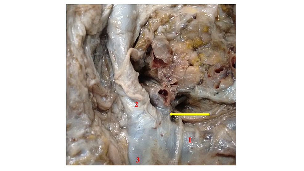 thoracic duct cadaver