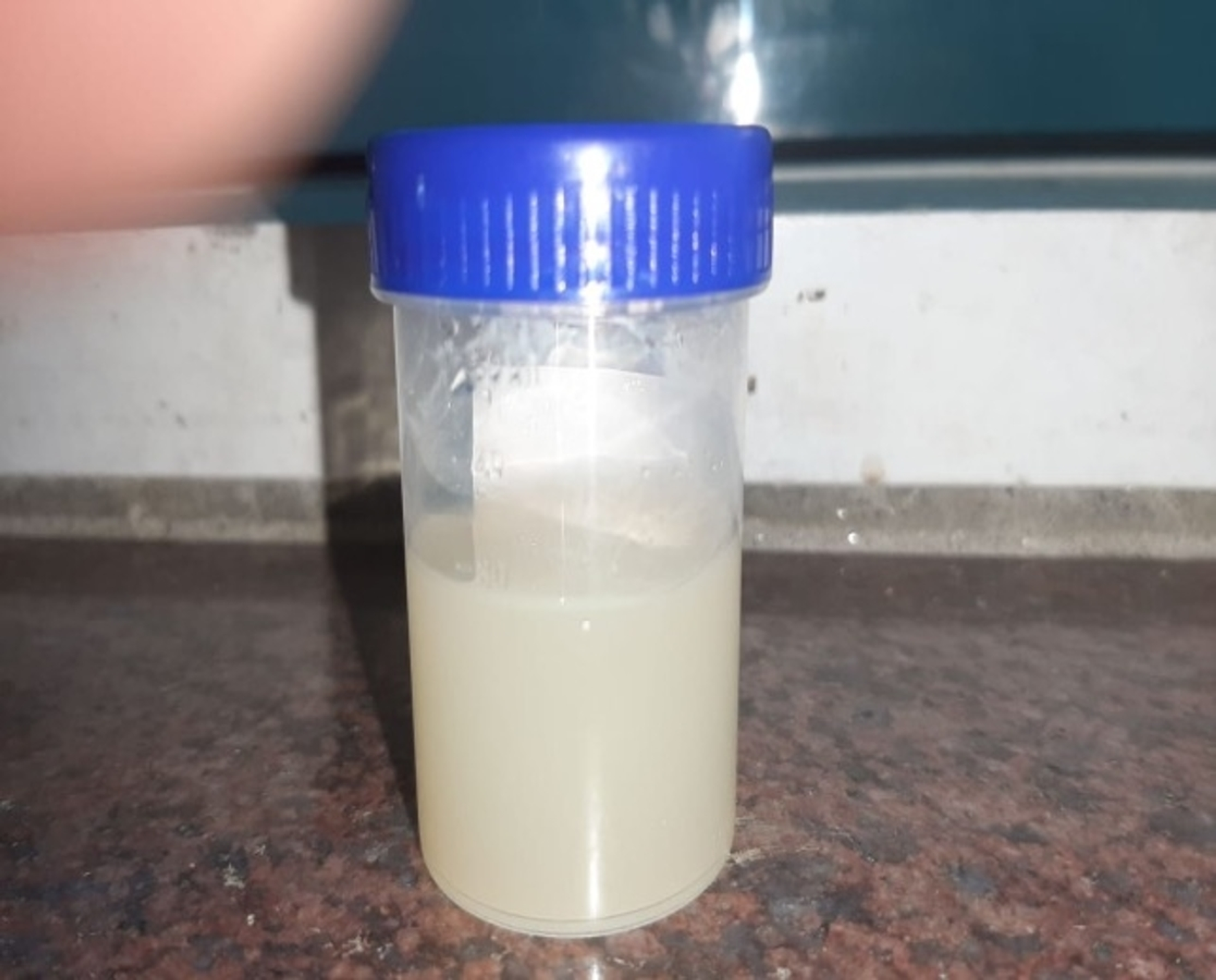 cloudy urine