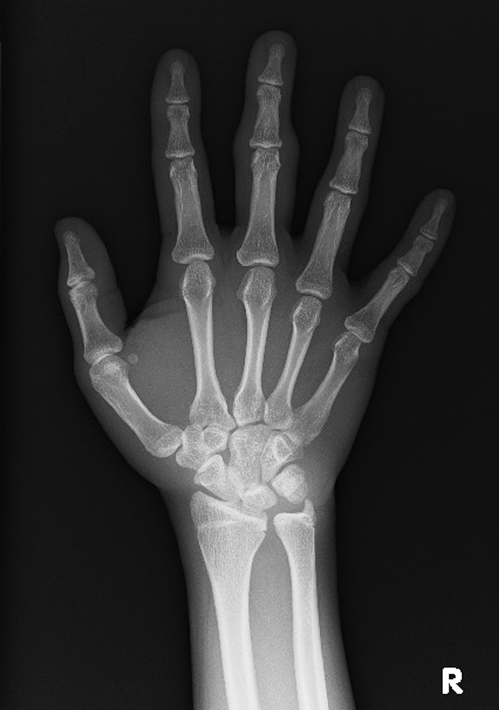 Plain X-ray