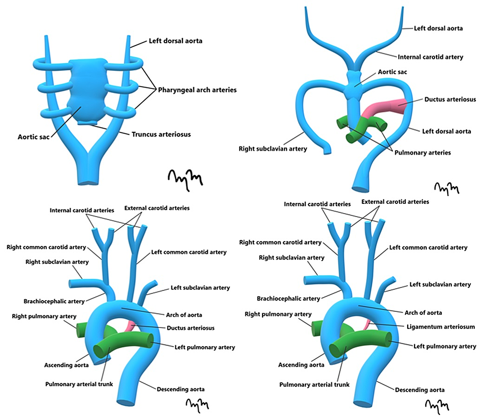 Cureus A Rare Case Of Congenital Internal Carotid Art - vrogue.co