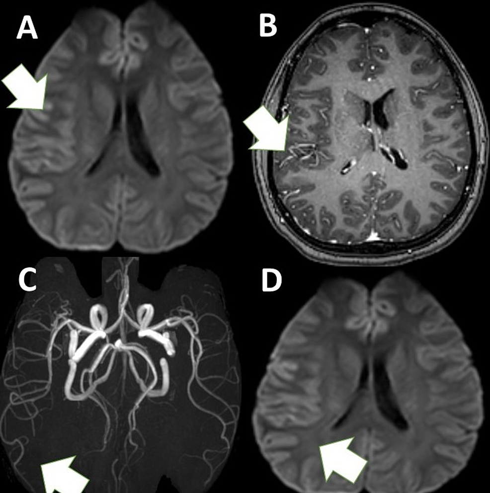 MRI-images.
