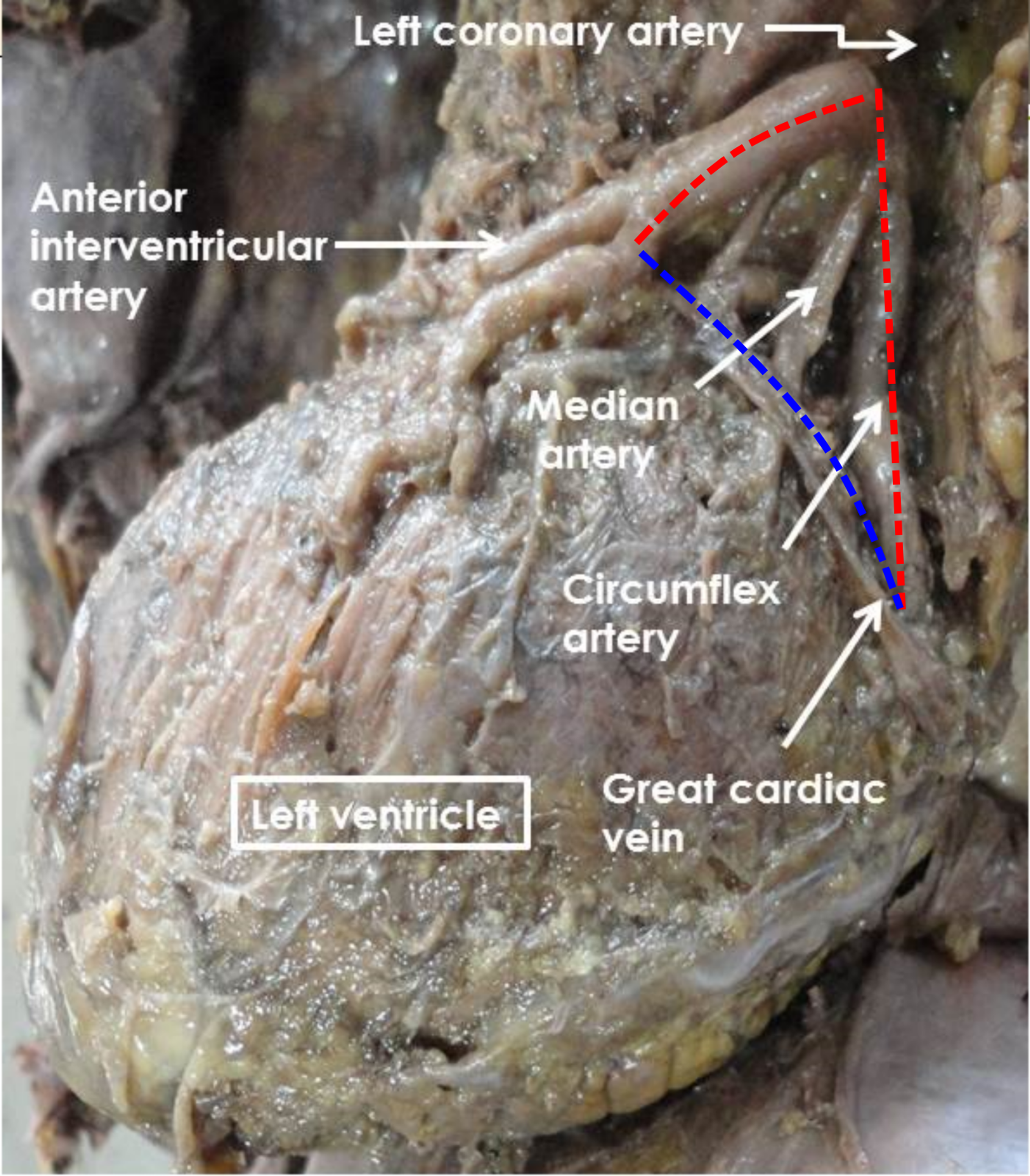 great cardiac vein cadaver