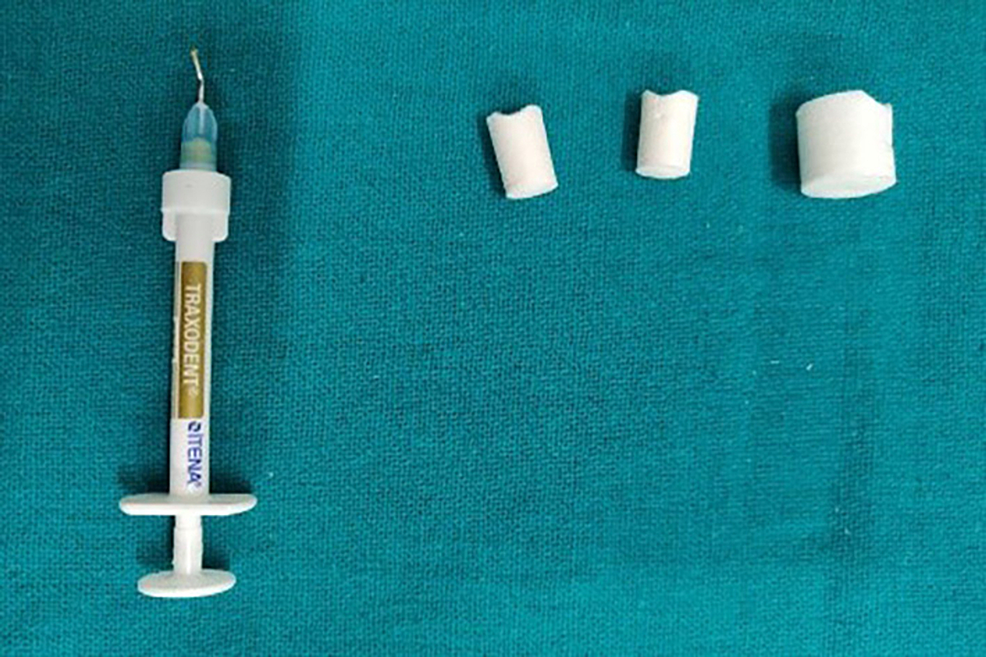 Cureus Comparative Evaluation of the Clinical Efficacy of Four