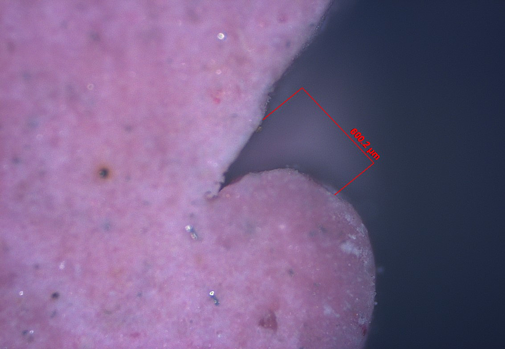Cureus Comparative Evaluation of the Clinical Efficacy of Four