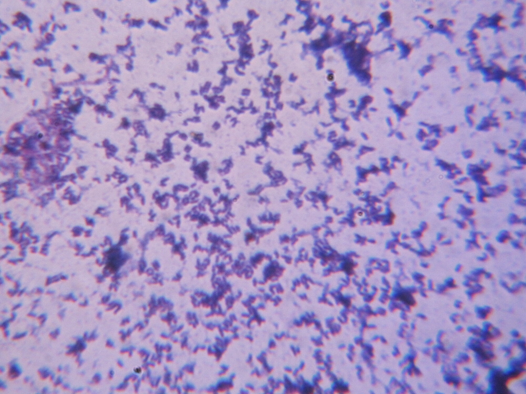 Cureus | Bacterial Colony: First Report of Donut Colony Morphology