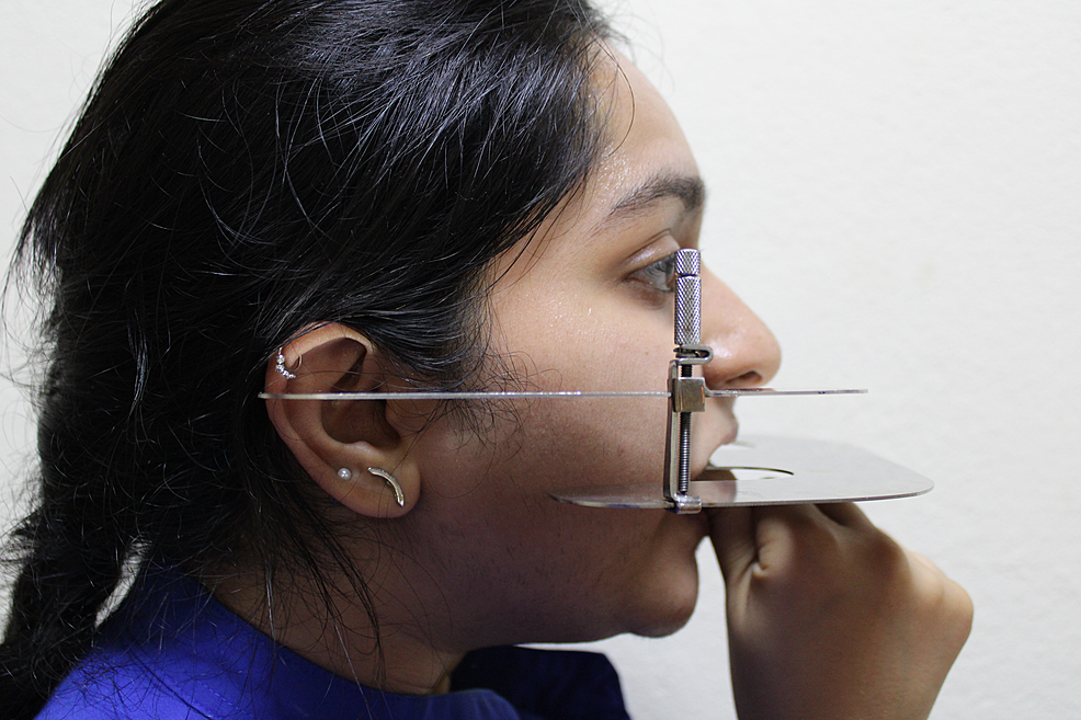 An Evaluation of the Relation Between Variation in Arch Forms and