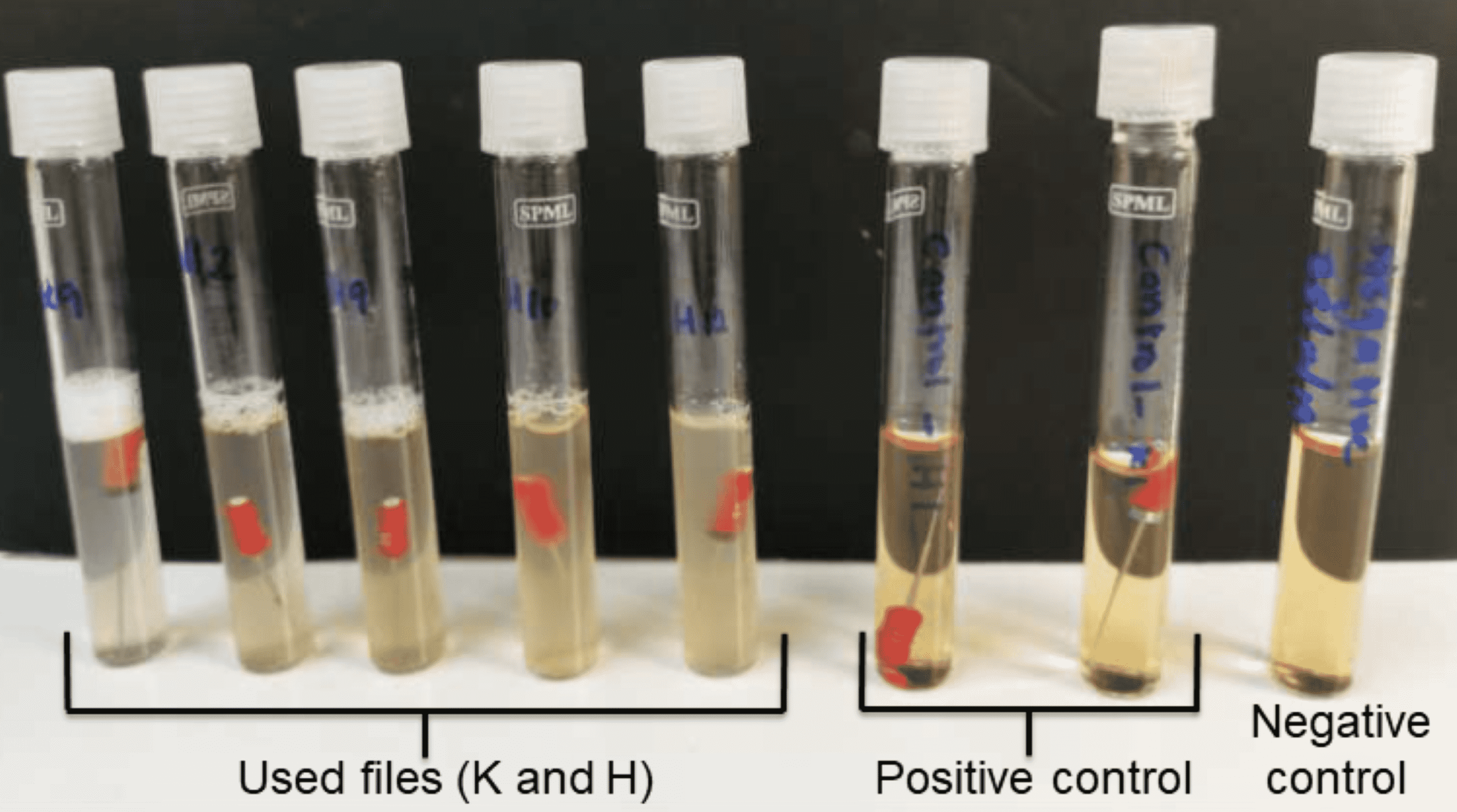 Cureus Microbial Culture and Scanning Electron Microscopic Evaluation