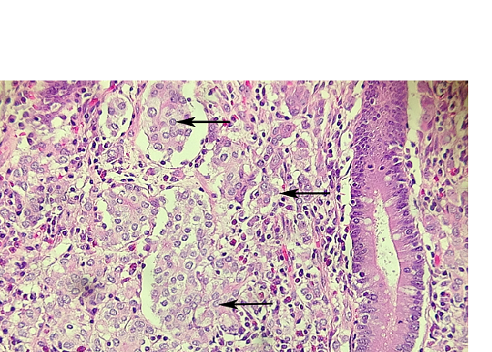 Hematoxylin-&-eosin-(H&E)-stain