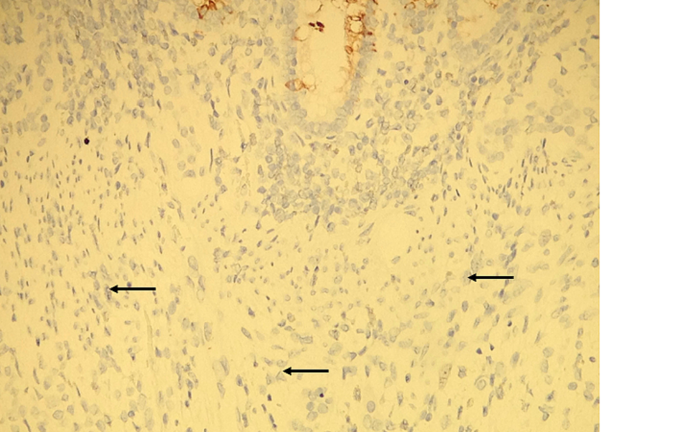 Immunohistochemistry-for-cytokeratin-20
