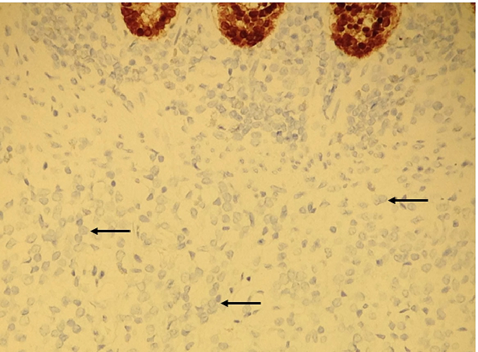 Immunohistochemistry-fo-CDX2