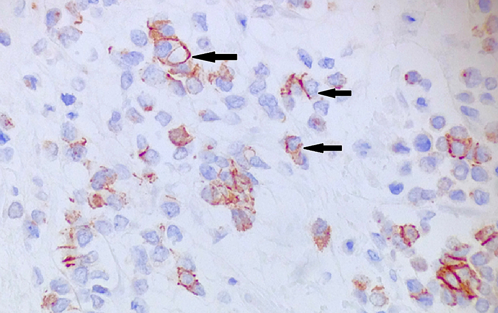 Immunohistochemistry-stain-for-E-cadherin