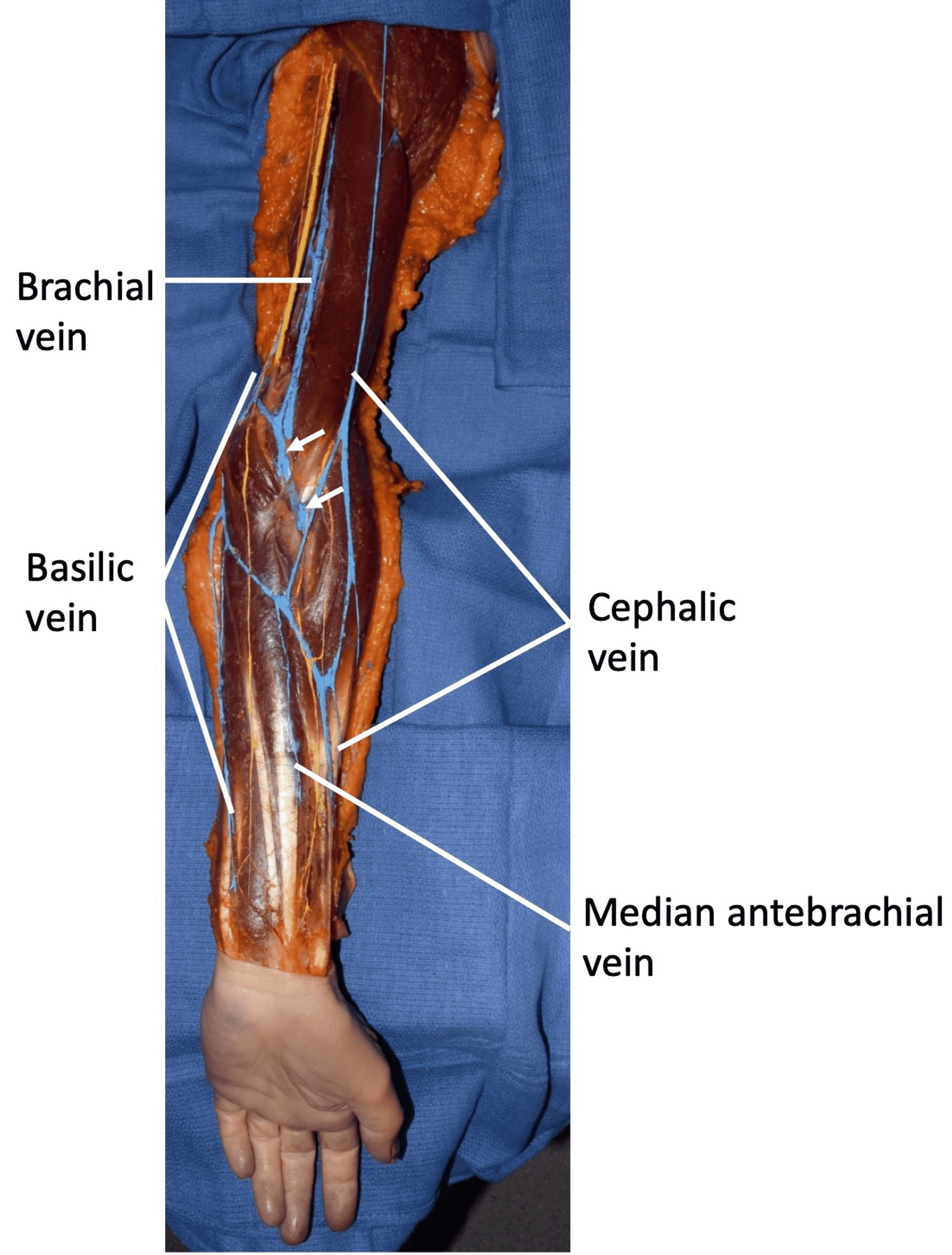 Antebrachial Fascia Anatomy